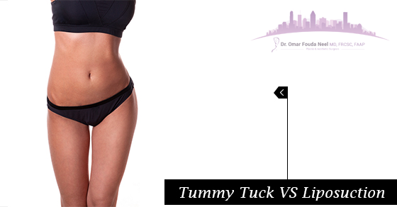 Tummy Tuck vs Liposuction: Which Do You Need?