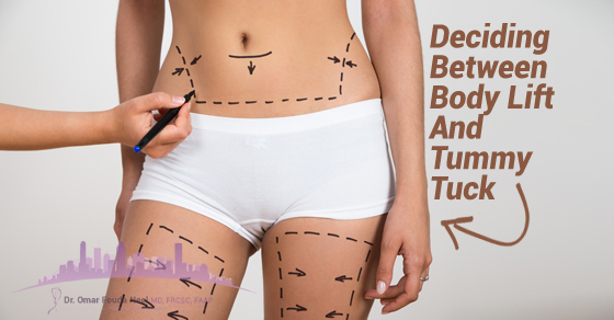 How to Choose Between a Body Lift and Tummy Tuck - Dr. Omar Fouda Neel